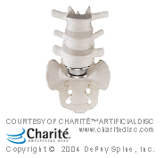 charite